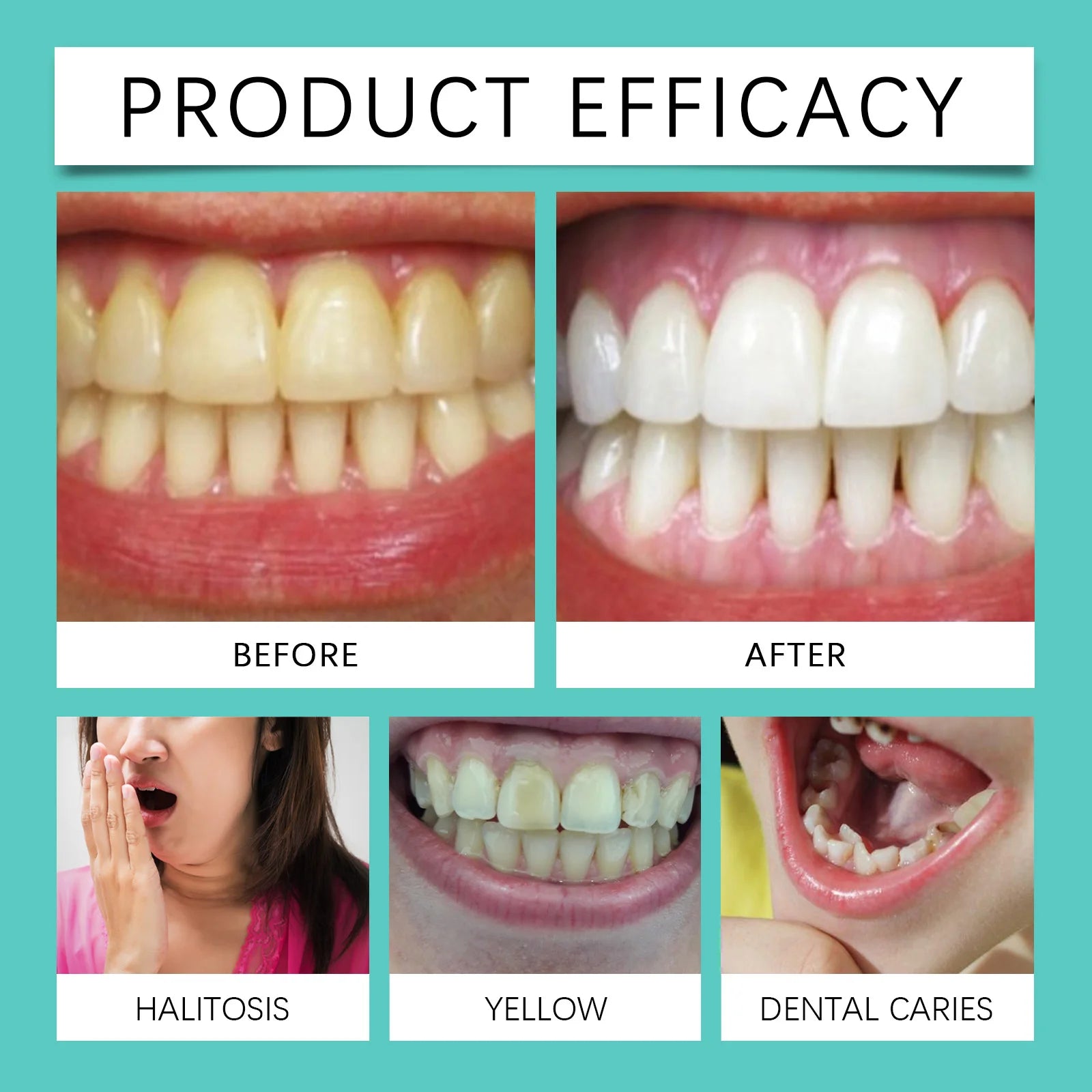 Tooth Whitening Strips