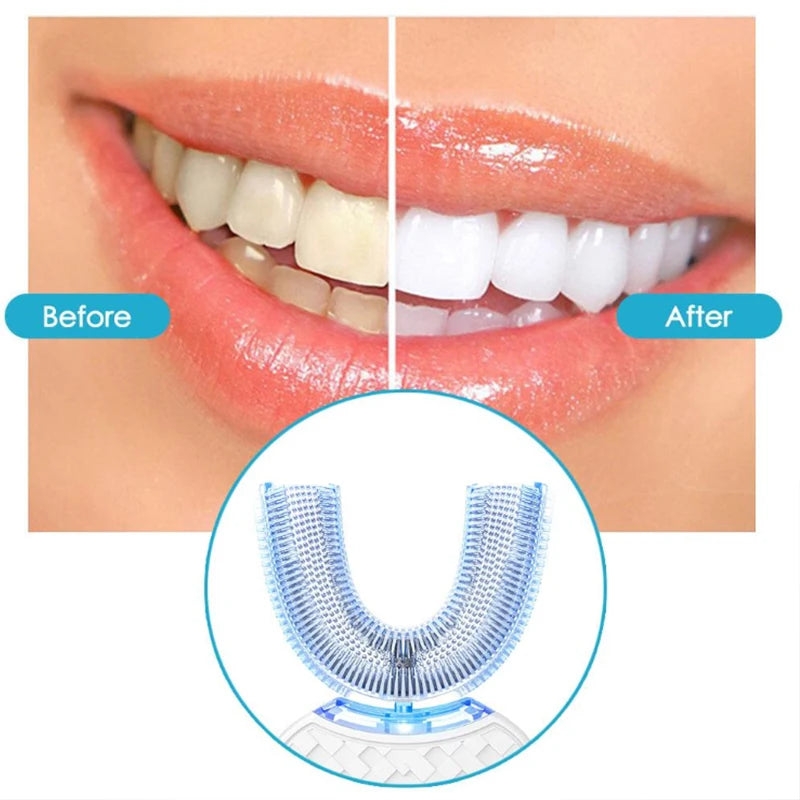 Intelligent Automatic U Blue Light Teeth Whitener